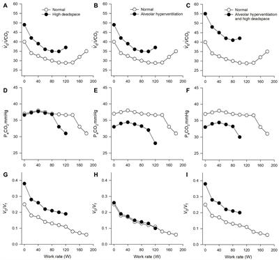 Measurement and Interpretation of Exercise Ventilatory Efficiency